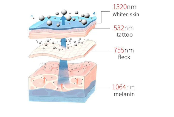 4in1 4000w Soprano Titanium Ice Platinum Diode 755 808 1064nm 4 Wavelength Laser ND:YAG Machine Painless Hair Removal Machine