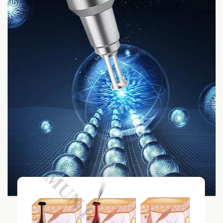 4in1 4000w Soprano Titanium Ice Platinum Diode 755 808 1064nm 4 Wavelength Laser ND:YAG Machine Painless Hair Removal Machine