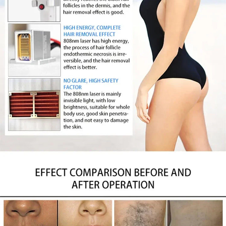 4in1 4000w Soprano Titanium Ice Platinum Diode 755 808 1064nm 4 Wavelength Laser ND:YAG Machine Painless Hair Removal Machine